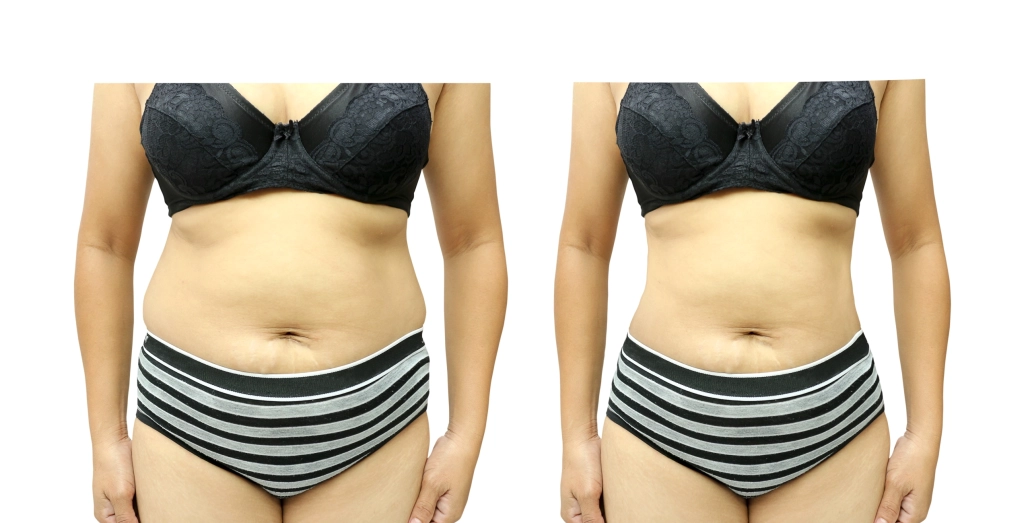 Echipament Dermocell